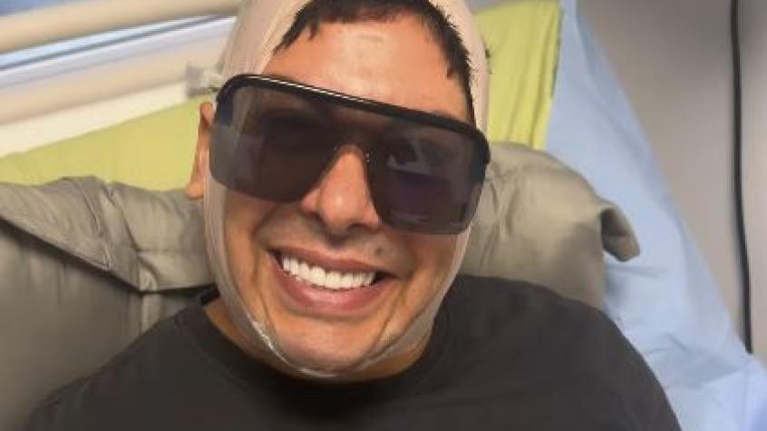 Con inédito video: Botota comparte complicado paso de su post operatorio tras cirugía