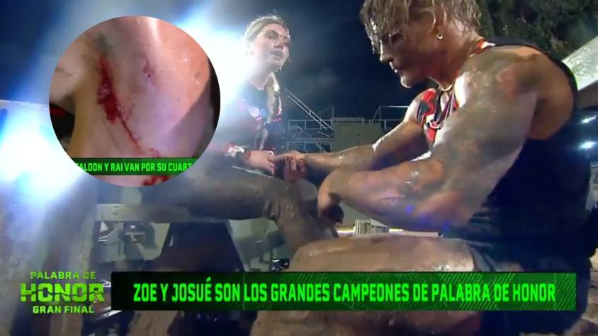 Revive cómo fue la desgarradora lesión de Raimundo en la final de Palabra de Honor
