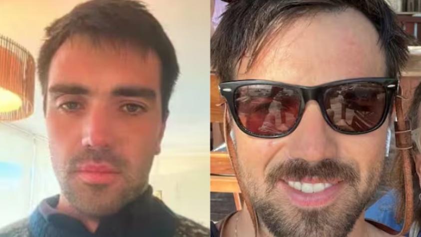 Agresor de conserje en Vitacura habría salido del país: no se descarta una orden de captura internacional