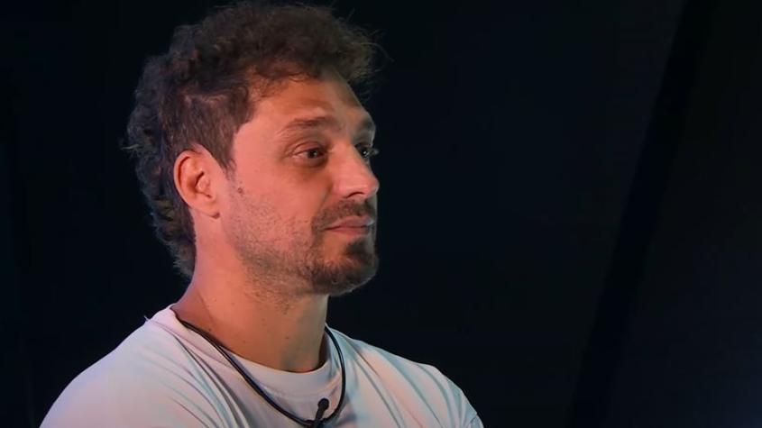 Joche Bibbó confesó la cirugía plástica a la que se sometió: "Me tuvieron que..."