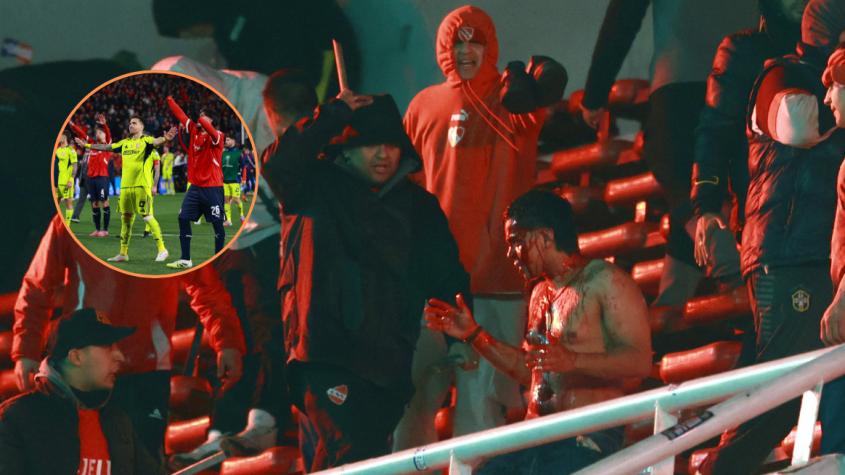 “¡Él no es chileno!”: argentino fue apuñalado por hinchas de Independiente tras defender a su amiga hincha de la U