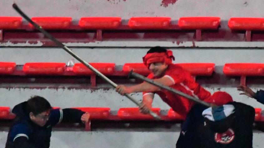 Los detalles de los graves incidentes entre U de Chile e Independiente: un herido de gravedad y detenidos