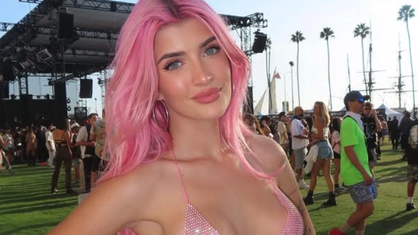 La hija de Charlie Sheen, Sami, mostró su antes y después: agradece radical transformación y retoques estéticos