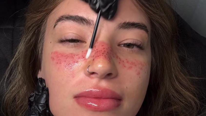 Influencer se tatúa pecas en la cara y responde a las críticas: "No se preocupen..."  
