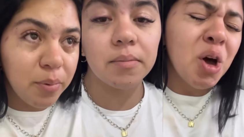 Joven venezolana acusa brutal agresión en La Vega Central: recibió patadas en la cabeza