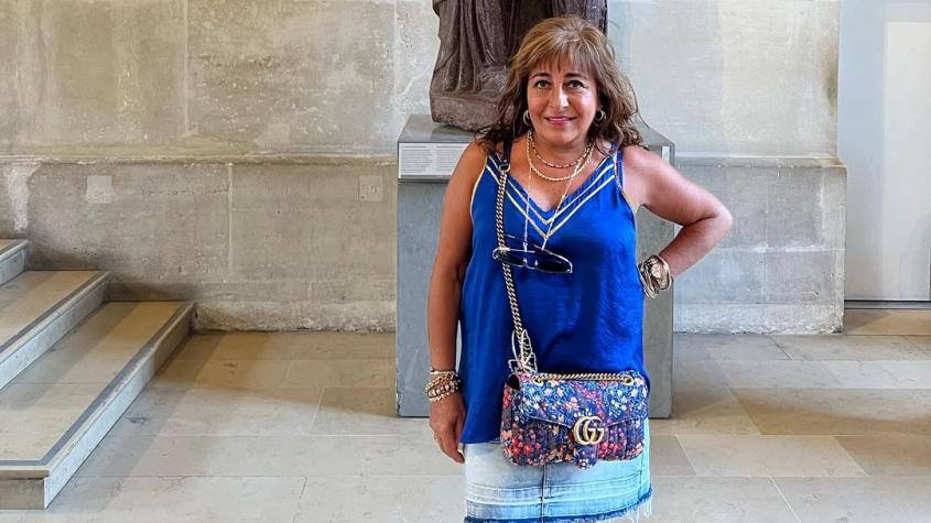 Helhue Sukni reveló las importantes operaciones estéticas a las que se sometió: una duró 8 horas