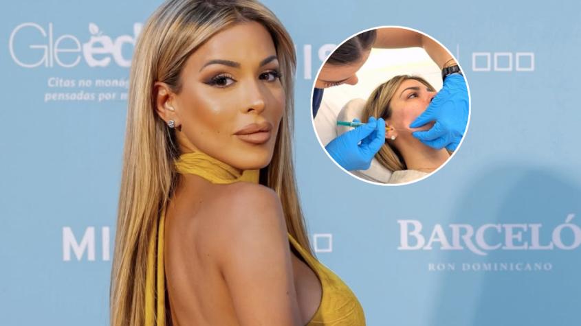 Oriana Marzoli se sometió a una intervención estética en la cara que incluyó largas agujas
