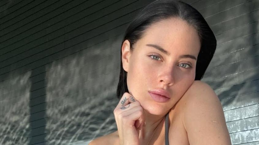 Ignacia Michelson reveló qué es la mancha roja de su cuello: "¿Qué te pasó?"