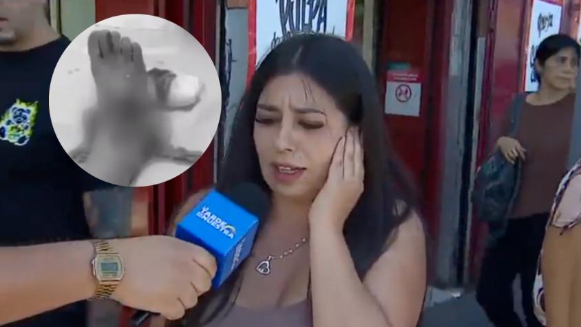 Niño de 4 años cayó en un hoyo en plena Alameda de Santiago: familia denuncia millonarios gastos en rehabilitación