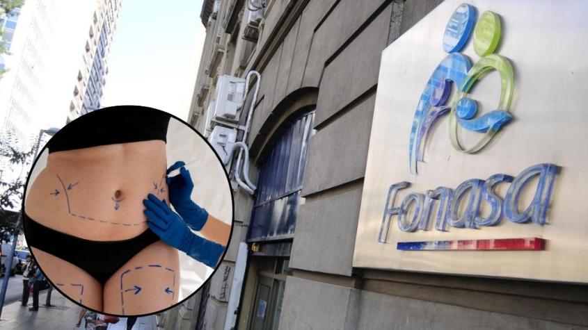 Bono PAD de abdominoplastia: este es el precio que debes pagar para decir adiós a la "guatita de delantal"