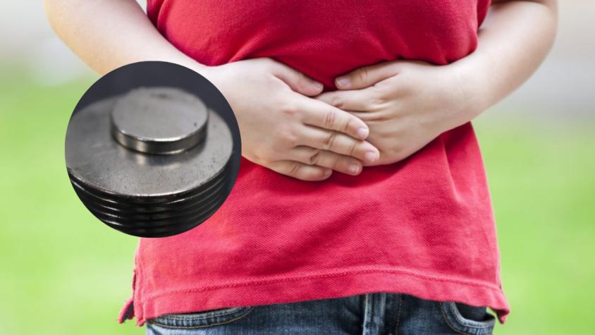 Especialista advierte por nuevo reto viral: niños tragan imanes y sufren graves daños